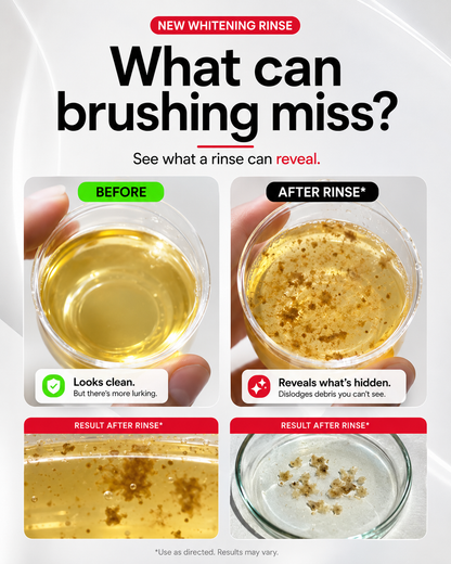 iD Stain Whitening Mouthwash