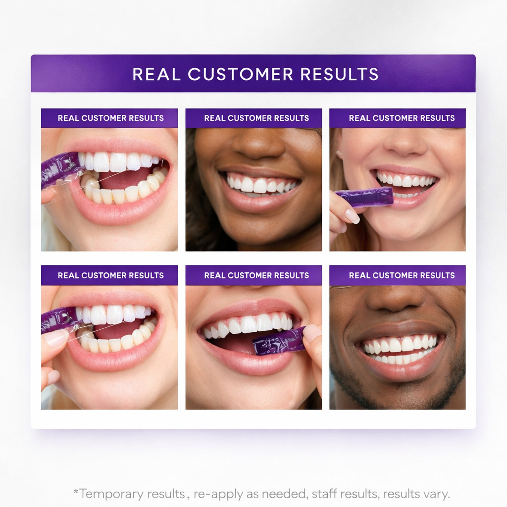 Purple Whitening Strips