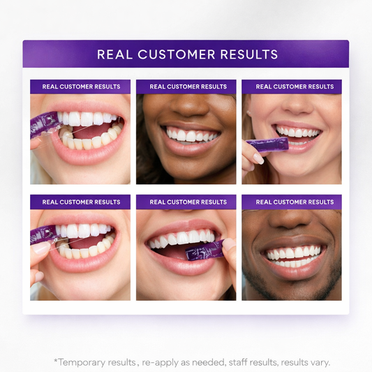 Purple Whitening Strips